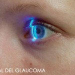 12 Marzo día internacional del Glaucoma