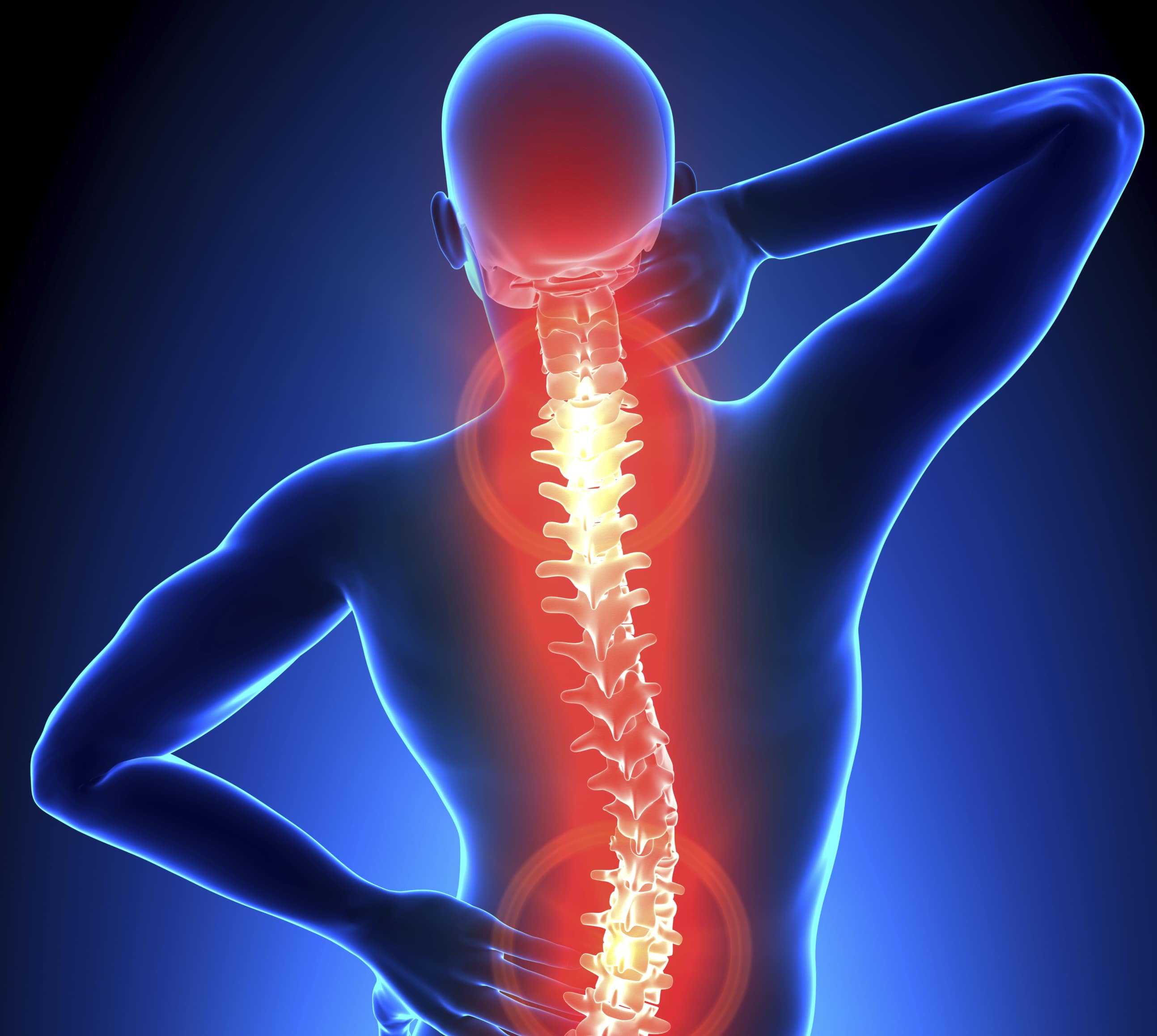 cómo aliviar el dolor de espalda